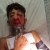 نور حمدان من العيسوية يفقد احدى عينيه بعد إصابته بالرصاص الاسفنجي